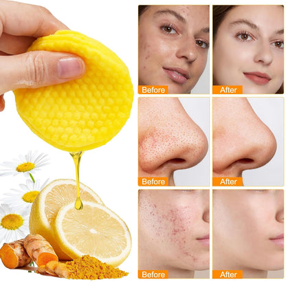 Revitalize Your Skin with Turmeric, Kojic Acid & Vitamin C Exfoliating Pads - 50 Count for Oil Control, Hydration & Dullness Reduction - Perfect for Face & Body!